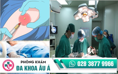 Cách chữa mụn nhọt hiệu quả, nhanh chóng