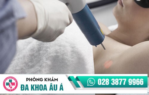 Cách trị mụn lưng đơn giản, đạt hiệu quả cao