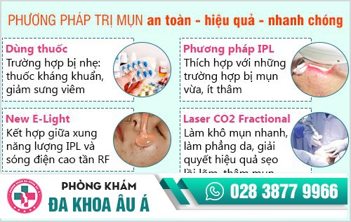 Phương pháp trị mụn