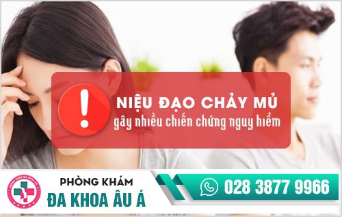 Niệu đạo chảy mủ có phải bệnh lậu không?