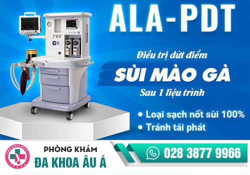 khám sùi mào gà ở đâu