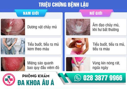 Đi tiểu buốt có mủ ở nam và nữ là dấu hiệu bệnh nguy hiểm