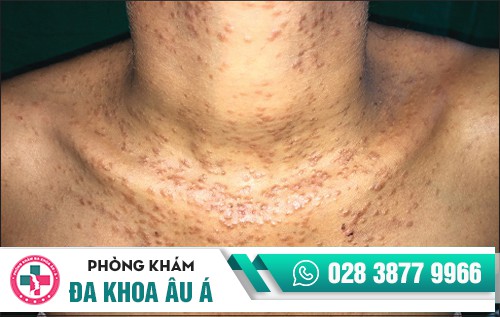 Phòng khám đa khoa âu á