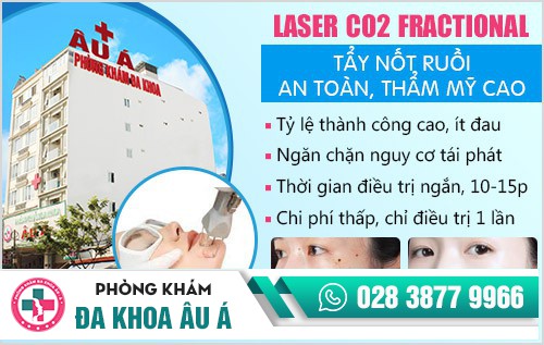 địa chỉ phá nốt ruồi