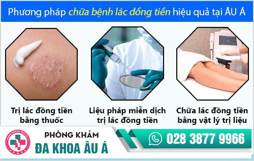 Lác đồng tiền