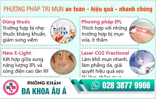 Phương pháp trị mụn